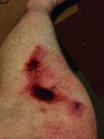 left_leg.jpg